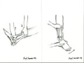 Ankle Anterior Drawer and Talar Tilt Print