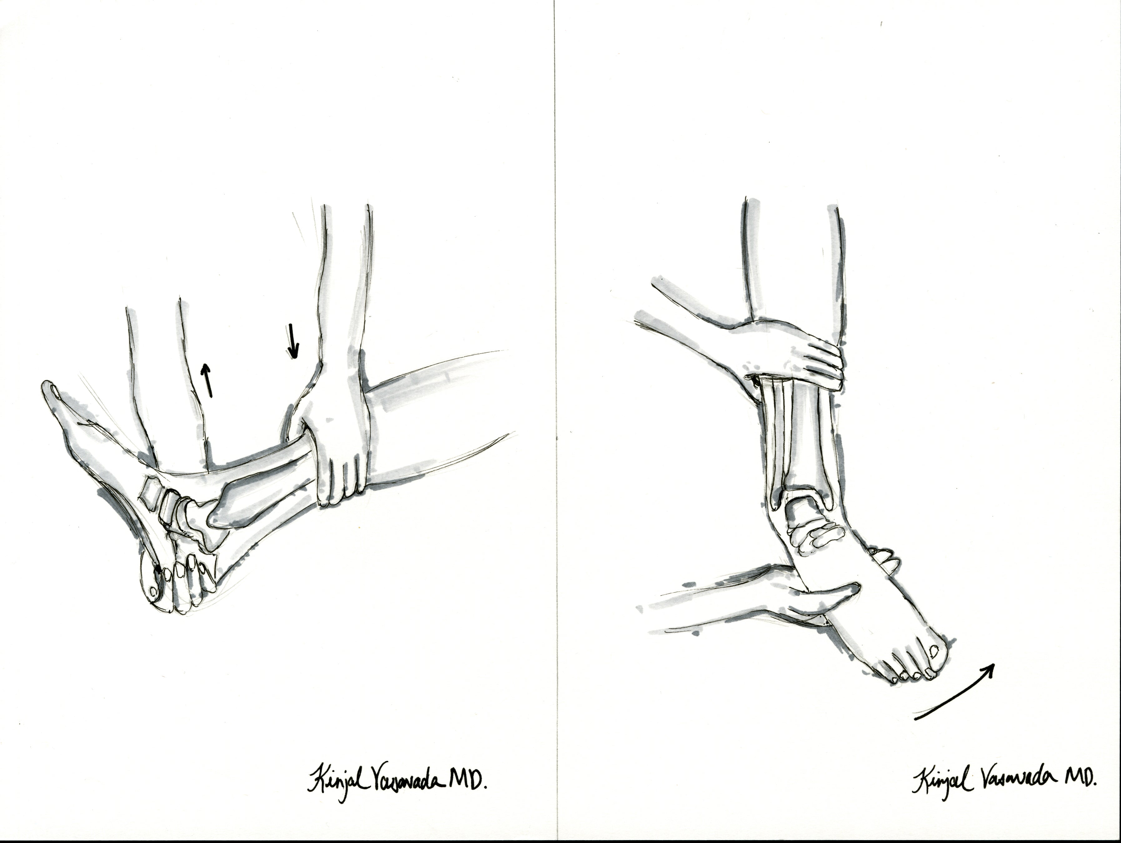 Ankle Anterior Drawer and Talar Tilt Print