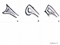 Normal and Dysplastic Glenoid Variants