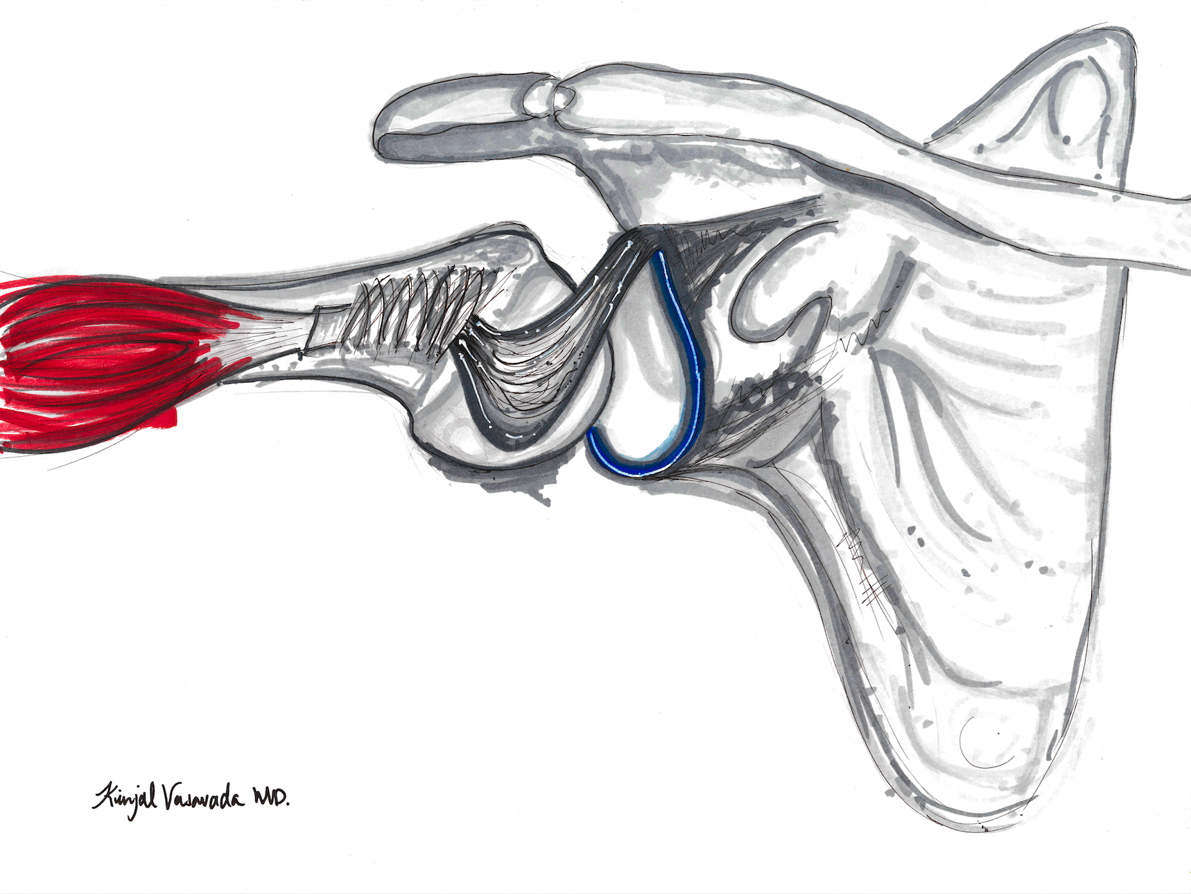 Hourglass Biceps Abduction ROM