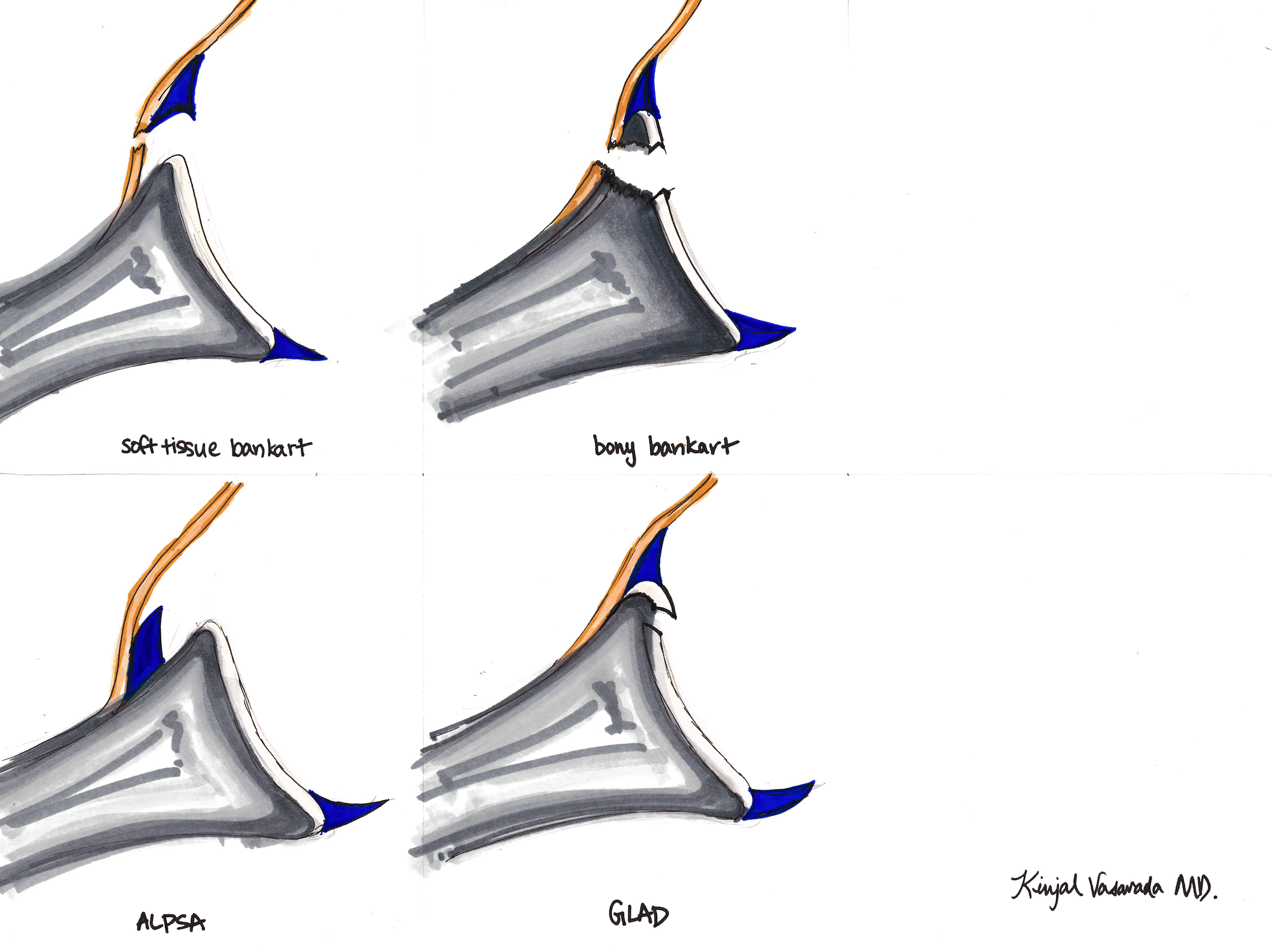 Labrum and Cartilage Injuries