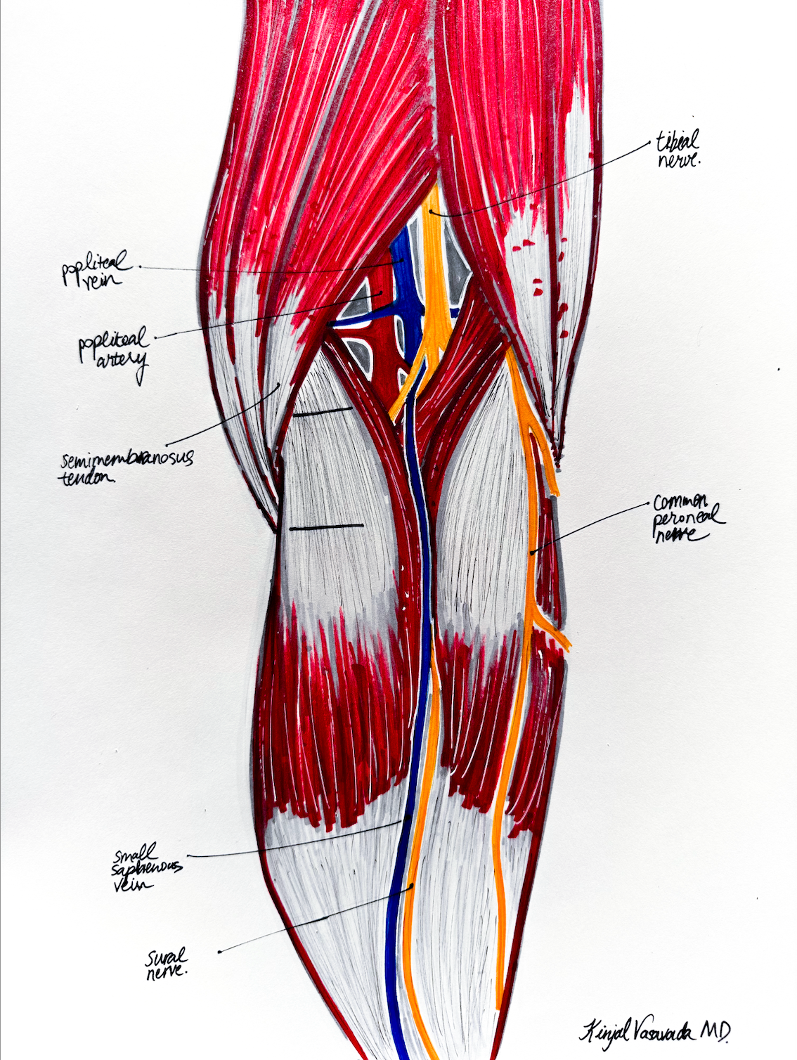 PMGR posterior knee