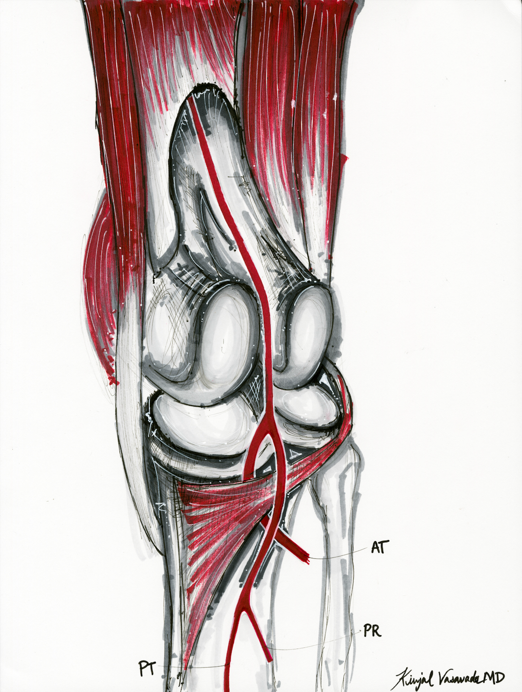Knee Scan II-A2
