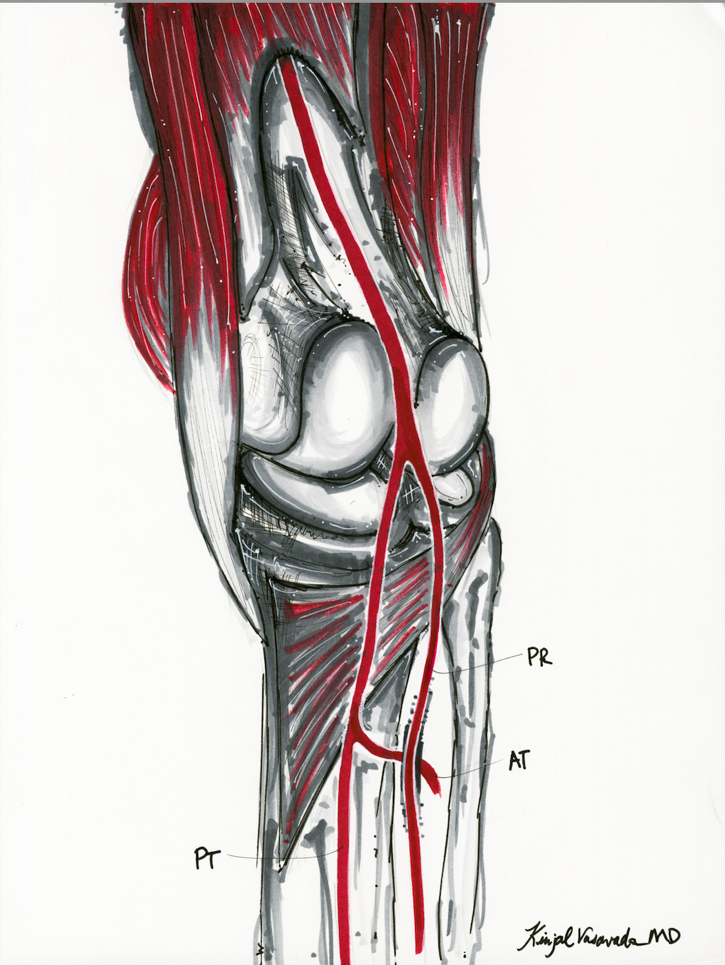 Knee Scan II-C