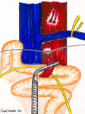 SMA Transposition 1
